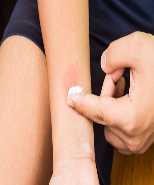 baking soda remedy for poison ivy