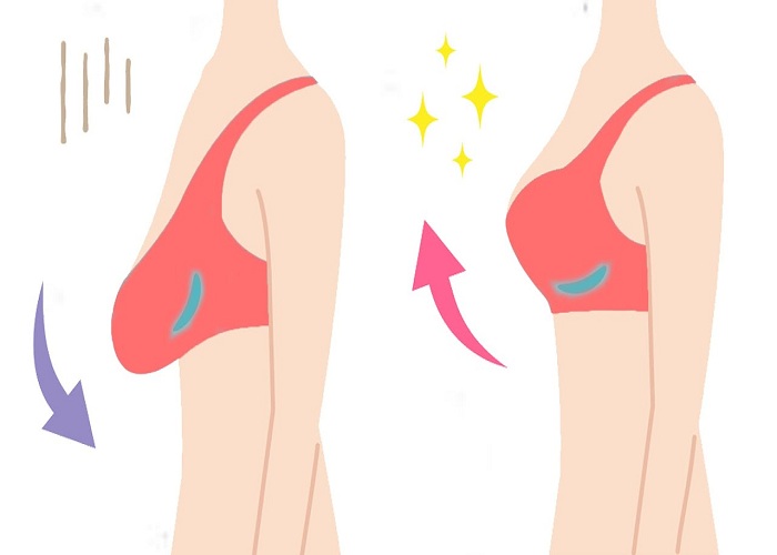 5 Exercises to tighten sagging breasts