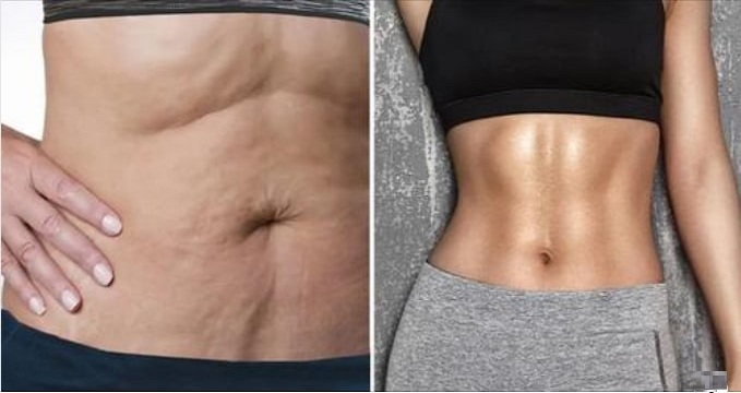 The-4-Most-Effective-Workouts-for-Firming-and-Toning-Your-Abs