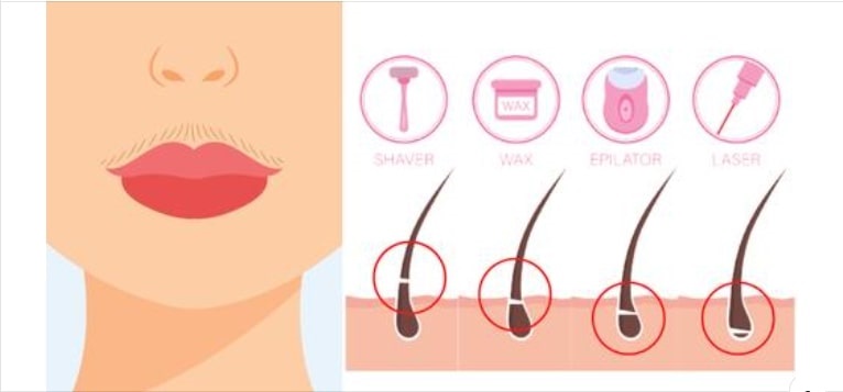 11-Natural-Techniques-to-Remove-Upper-Lip-Hair-at-Home