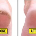 easy-home-remedies-to-get-rid-of-cracked-heels