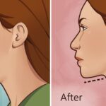 5-Effective-Exercises-to-Reduce-Double-Chin-and-Neck-Fat