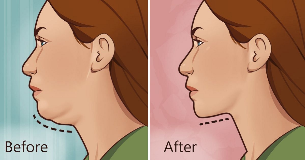 5-Effective-Exercises-to-Reduce-Double-Chin-and-Neck-Fat