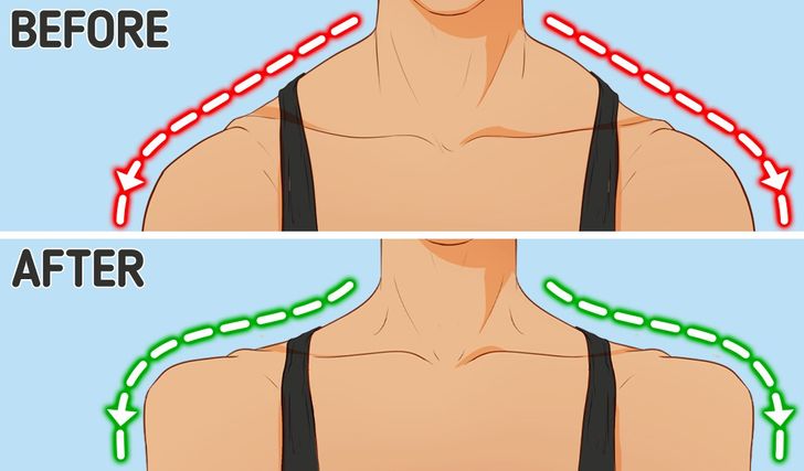 how-long-it-takes-to-fix-rounded-shoulders