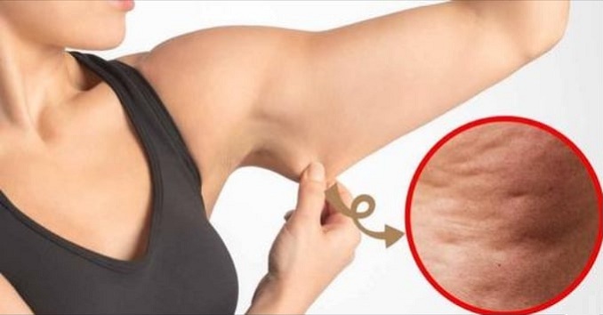 Get-Rid-of-Arm-Cellulite