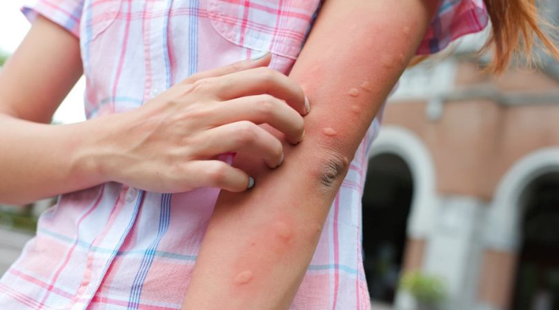 Banish Mosquitoes from Your Yard: 4 Powerful Natural Methods That Actually Work!