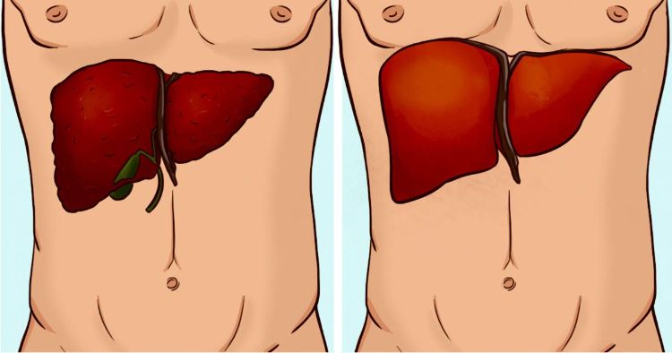 Give-your-liver-a-helping-hand