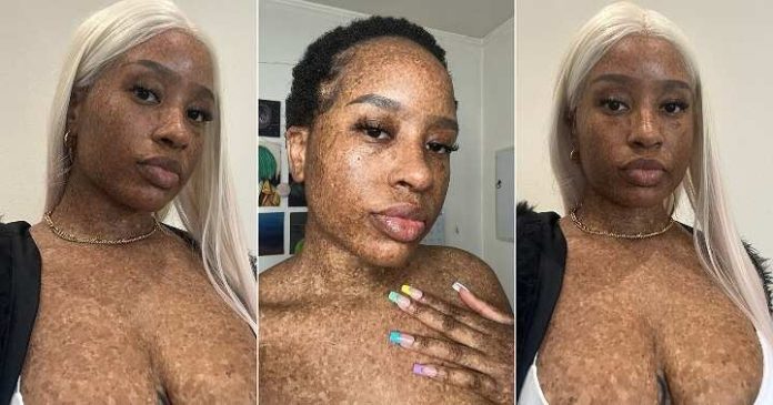 You-wont-believe-what-this-Lady-just-revealed-on-Twitter-Her-jaw-dropping-body-showcases-stunning-freckles-and-the-internet-is-going-wild