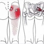 10-Piriformis-Stretches-To-Help-You-Get-Rid-Of-Sciatica-Hip-And-Lower-Back-Pain