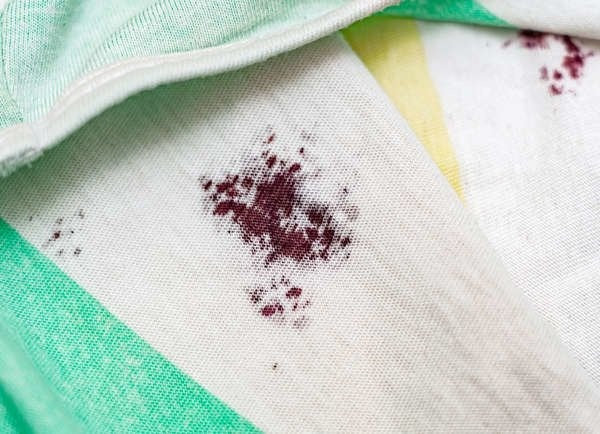 Banish-Laundry-Stains