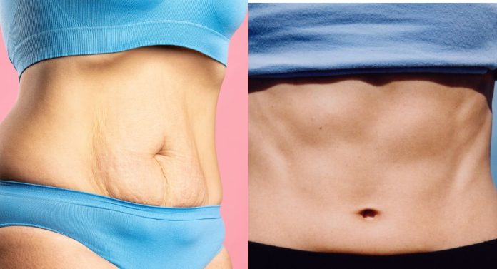 Discover-the-Ultimate-4-Miracle-Exercises-to-Banish-Belly-Flab-and-Sculpt-Your-Abs