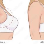 Shocking-Discover-the-Ultimate-10-Exercises-to-Banish-Underarm-Fat-Forever