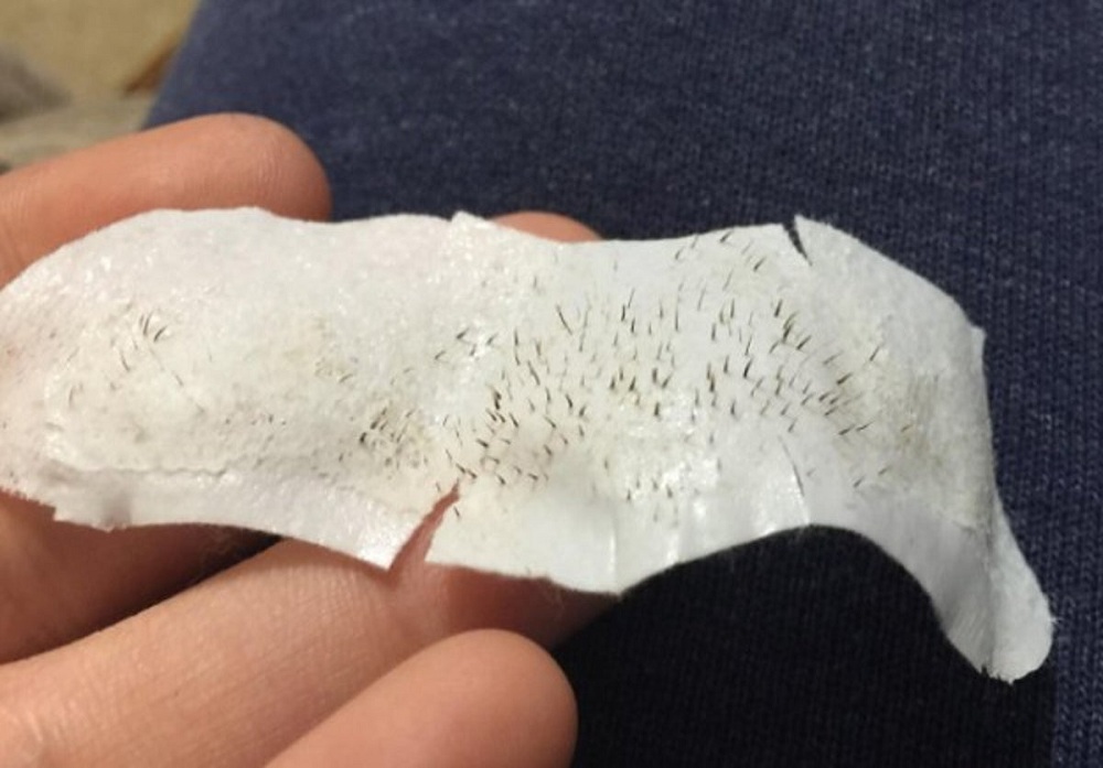 milk-pore-strip